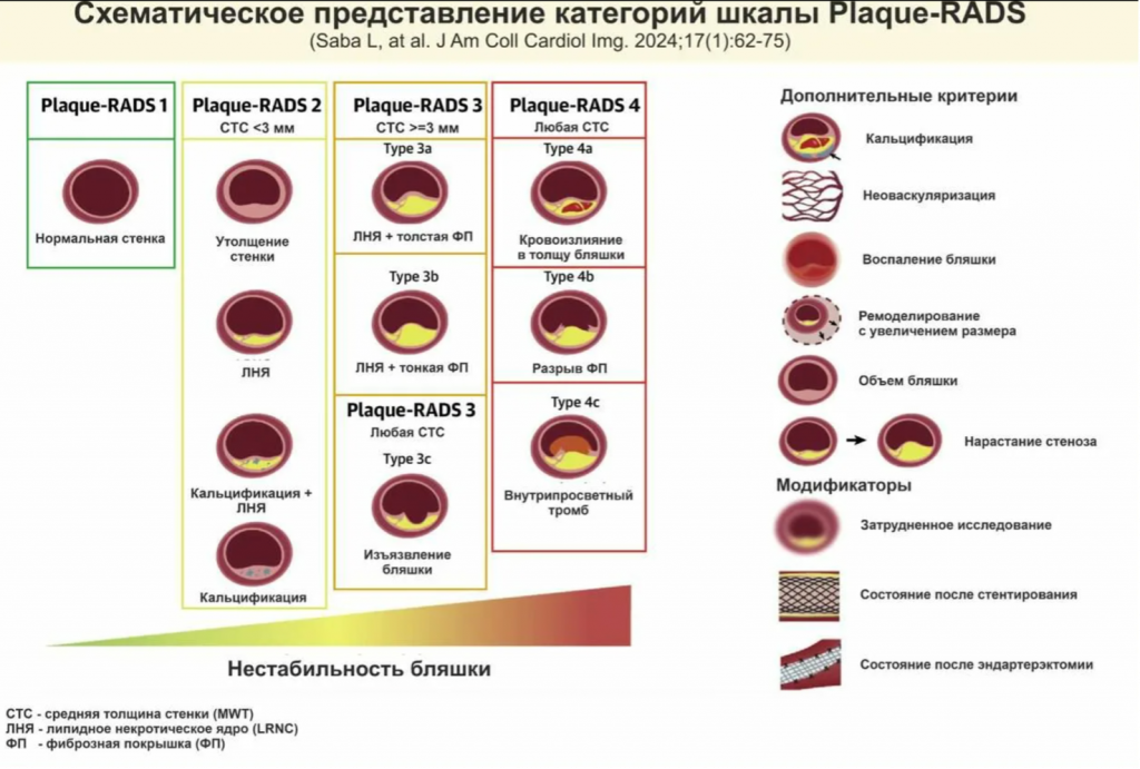 Схема категорий шкалы Plaque-RADS от 1 до 4